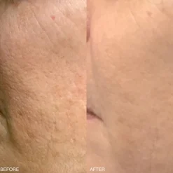 High Performance Face Cream