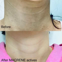 High Performance Neck and Décolletage Treatment